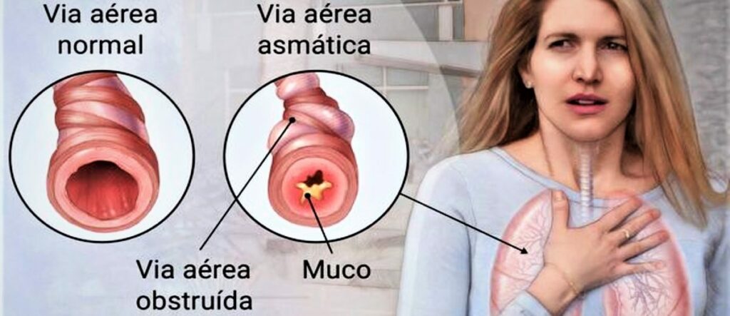 Asma